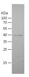    PRKCZ / Recombinant Human PRKCZ