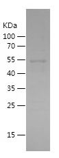    Sortilin / Recombinant Human Sortilin