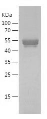    TNNT2 / Recombinant Human TNNT2