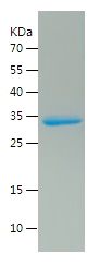    MIF / Recombinant Human MIF