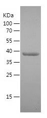    DDX3Y / Recombinant Human DDX3Y