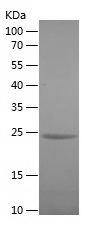    SPA17 / Recombinant Human SPA17