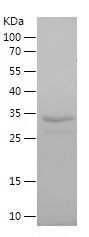    SLC22A6 / Recombinant Human SLC22A6