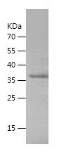    SEMA4D / Recombinant Human SEMA4D