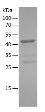    CAMSAP2 / Recombinant Human CAMSAP2