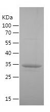    HSD11B1 / Recombinant Human HSD11B1