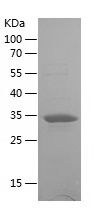    UPB1 / Recombinant Human UPB1