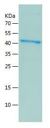    NLRP3 / Recombinant Human NLRP3