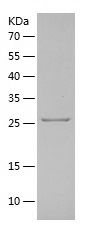    KLK2 / Recombinant Human KLK2