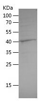    GDI2 / Recombinant Human GDI2