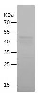    RSPO3 / Recombinant Human RSPO3