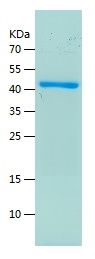    SART3 / Recombinant Human SART3