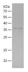    FGL2 / Recombinant Human FGL2