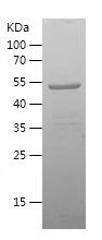    SLC20A1 / Recombinant Human SLC20A1