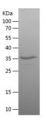    SMN-2 / Recombinant Human SMN-2