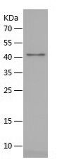    SFTPA1 / Recombinant Human SFTPA1