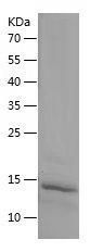    SAA2 / Recombinant Human SAA2