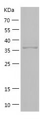    SLC5A8 / Recombinant Human SLC5A8