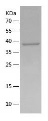    CCRL2 / Recombinant Human CCRL2