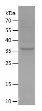    CCDC25 / Recombinant Human CCDC25