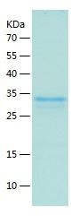 Recombinant Mouse BNP