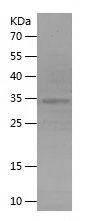    ANP / Recombinant Human ANP