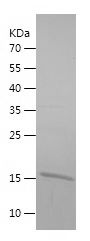    SSBP1 / Recombinant Human SSBP1