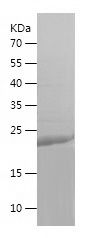    UBE2T / Recombinant Human UBE2T