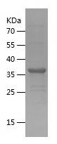    UBE2D1 / Recombinant Human UBE2D1