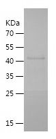    ZP3 / Recombinant Human ZP3