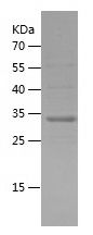    SYNJ2BP / Recombinant Human SYNJ2BP