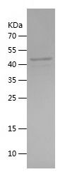    RUNX2 / Recombinant Human RUNX2