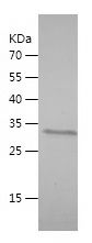    SMARCAL1 / Recombinant Human SMARCAL1