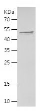    PHF14 / Recombinant Human PHF14