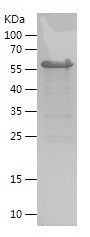    MAGED4 / Recombinant Human MAGED4