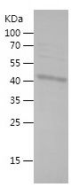    ZMYND10 / Recombinant Human ZMYND10