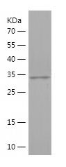    IRF1 / Recombinant Human IRF1