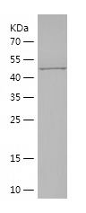    MYH2 / Recombinant Human MYH2