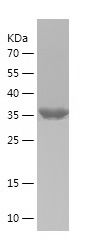    MKK4 / Recombinant Human MKK4