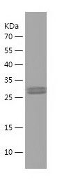 Recombinant Rat bnp