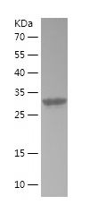    TNP1 / Recombinant Human TNP1