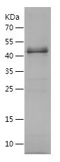    YTHDF2 / Recombinant Human YTHDF2