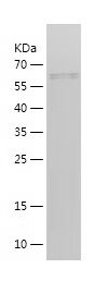    GLTSCR2 / Recombinant Human GLTSCR2