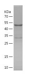    SYNGAP1 / Recombinant Human SYNGAP1