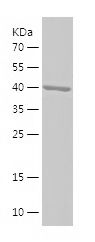    C8A / Recombinant Human C8A