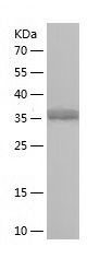    Bcl-3 / Recombinant Human Bcl-3