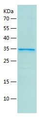 Recombinant Mouse  ANP