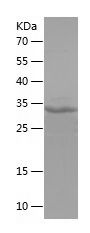    STYK1 / Recombinant Human STYK1