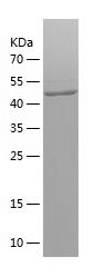    ABCD1 / Recombinant Human ABCD1