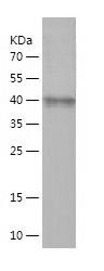    ADAM8 / Recombinant Human ADAM8